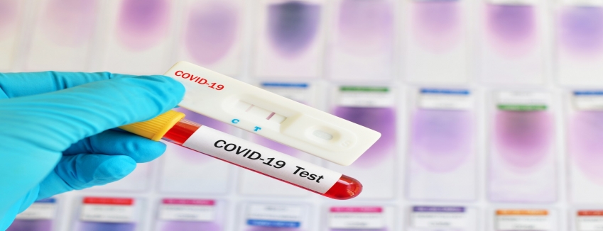 Τι είναι τα rapid test που χρησιμοποιεί ο ΕΟΔΥ και πόσο αξιόπιστα είναι;