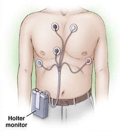 Holter ρυθμού 24/48 ώρου - Περιπατητική ηλεκτροκαρδιογραφία